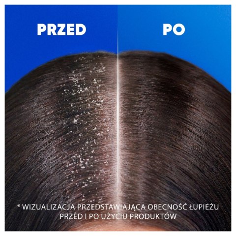 Szampon przeciwłupieżowy Head & Shoulders Anti Hair Fall z kofeiną 400ml Szampon przeciwłupieżowy Head & Shoulders Anti Hair Fall z kofeiną 400ml